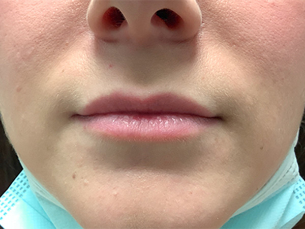 Injectables And Fillers 01