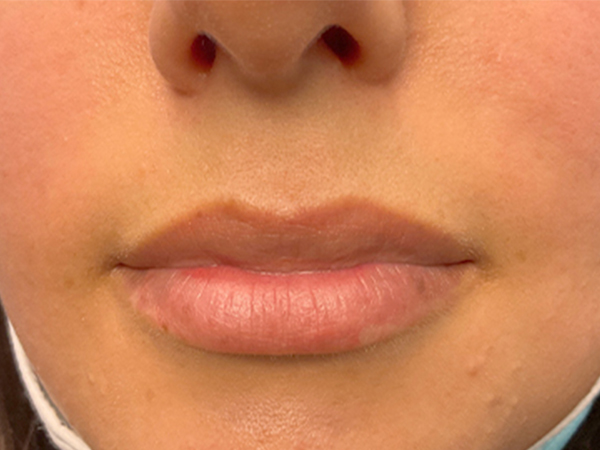 Injectables And Fillers 01