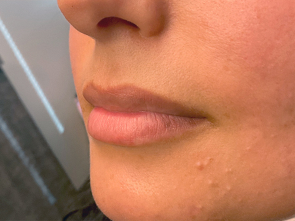 Injectables And Fillers 03