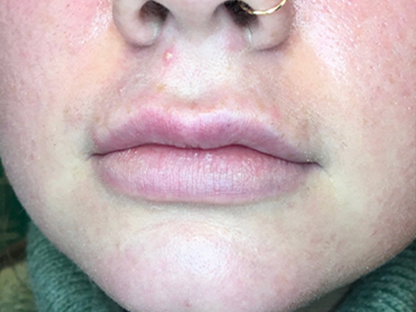 Injectables And Fillers 01