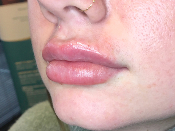 Injectables And Fillers 03