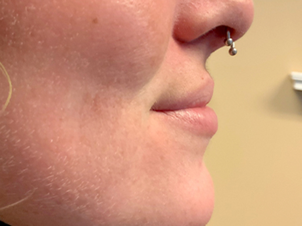 Injectables And Fillers 05