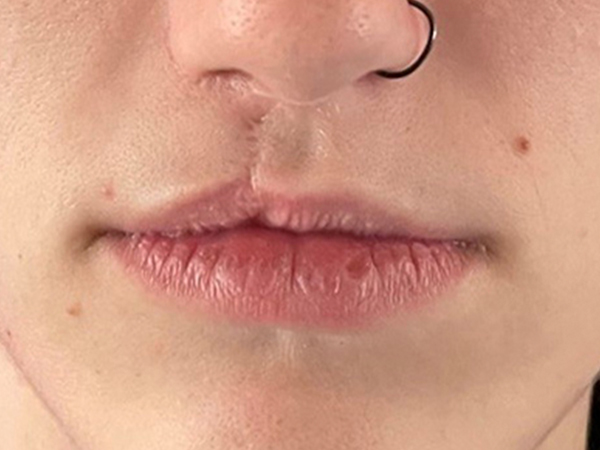 Injectables And Fillers 01