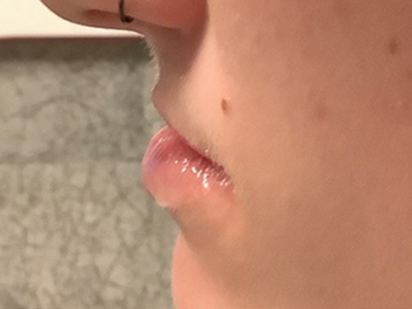 Injectables And Fillers 03