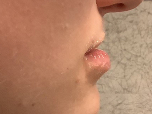 Injectables And Fillers 05