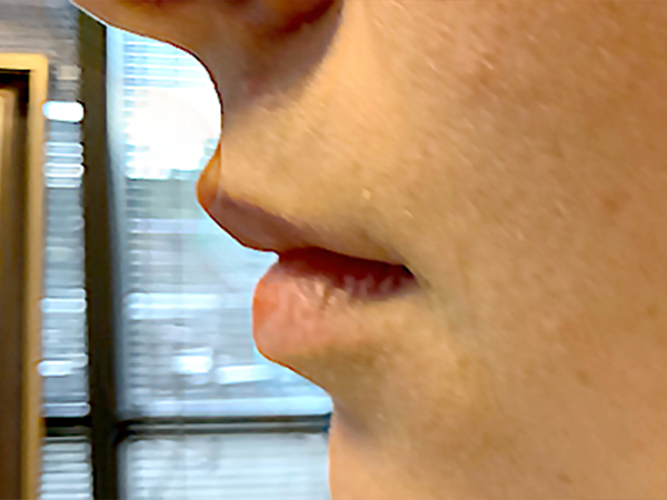 Injectables And Fillers 03