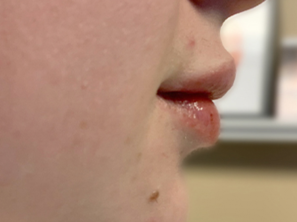 Injectables And Fillers 05