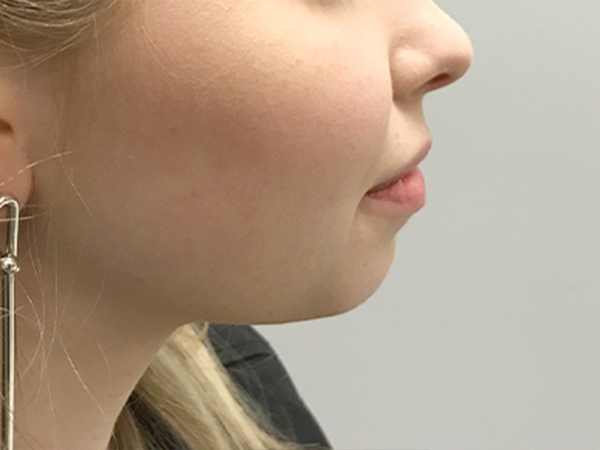 Injectables And Fillers 07