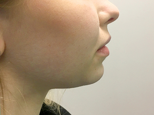 Injectables And Fillers 07