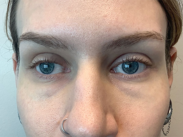 Injectables And Fillers 01