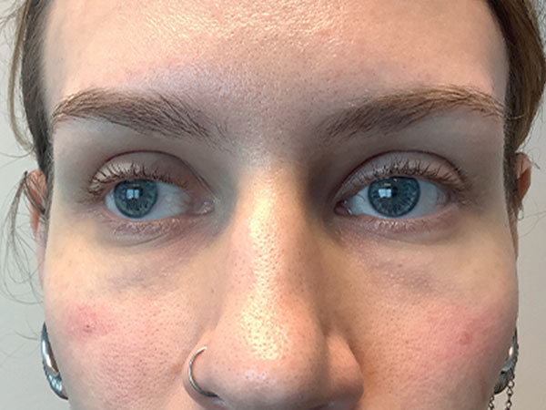 Injectables And Fillers 177