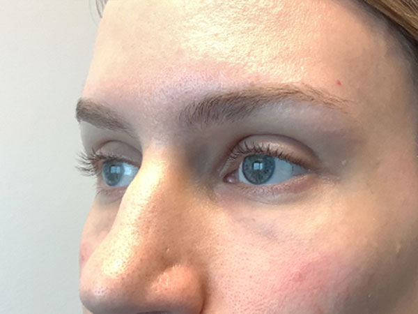 Injectables And Fillers 03