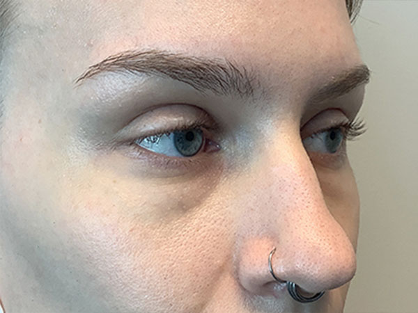 Injectables And Fillers 05