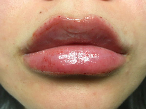 Injectables And Fillers 19