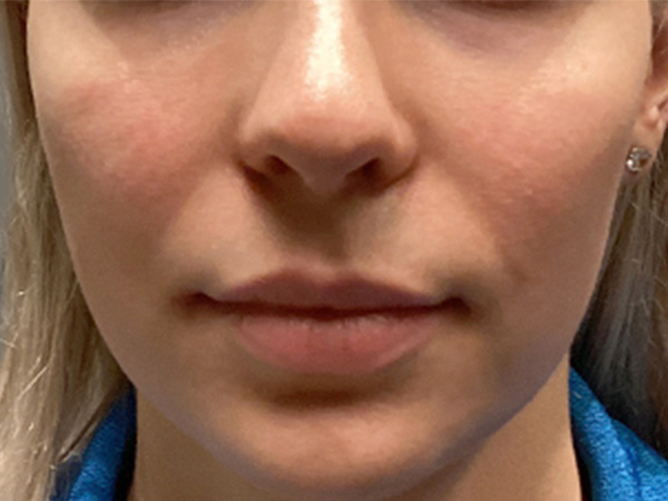 Injectables And Fillers 01