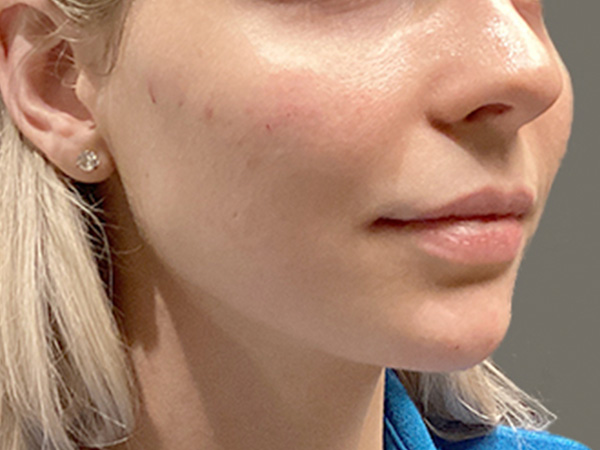 Injectables And Fillers 03