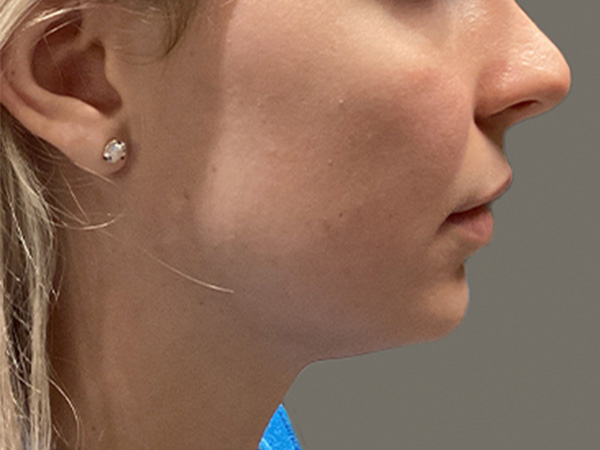 Injectables And Fillers 05