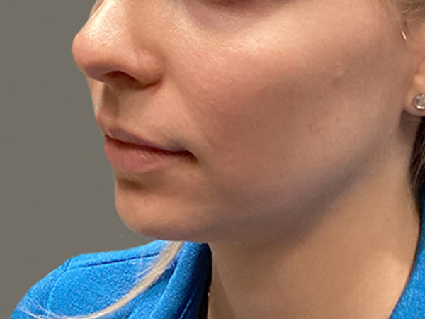 Injectables And Fillers 07