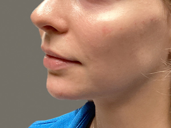 Injectables And Fillers 07