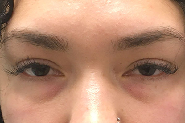 Injectables And Fillers 01