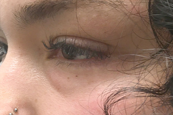 Injectables And Fillers 03