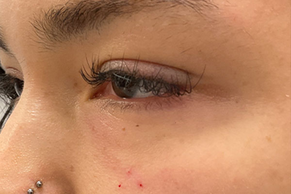 Injectables And Fillers 03