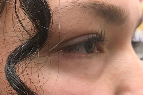 Injectables And Fillers 05