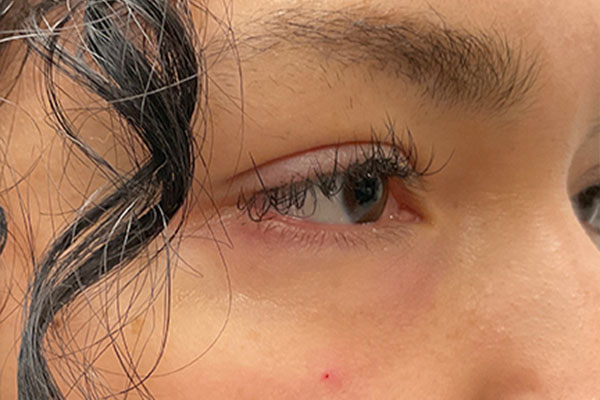 Injectables And Fillers 05