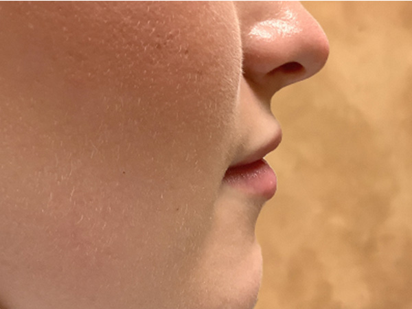 Injectables And Fillers 03