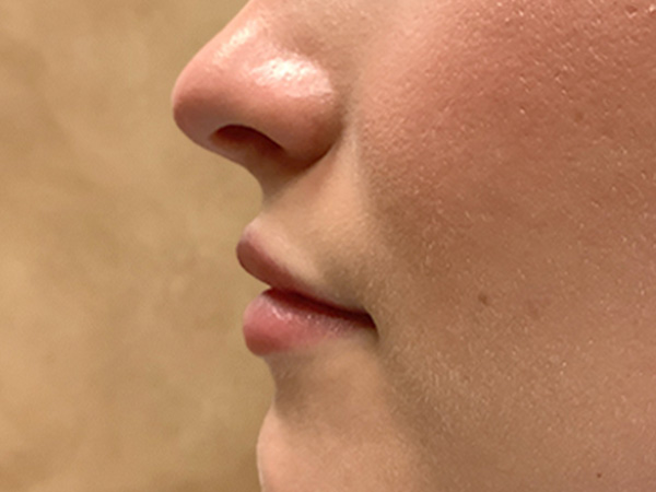 Injectables And Fillers 05