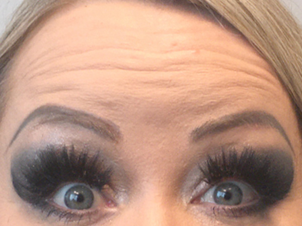 Injectables And Fillers 01