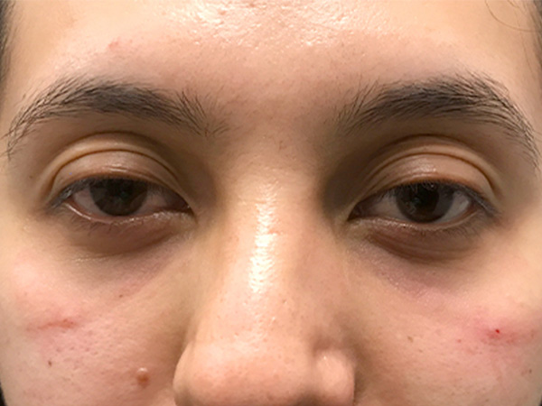 Injectables And Fillers 28