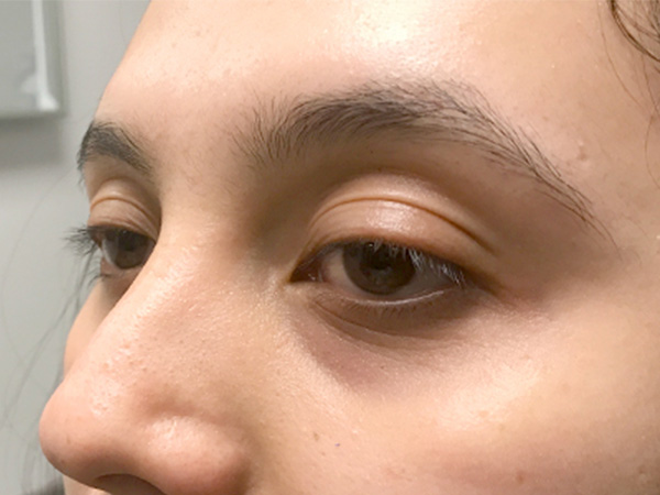 Injectables And Fillers 03