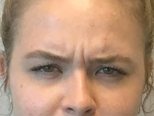 Injectables And Fillers 01