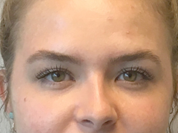 Injectables And Fillers 29