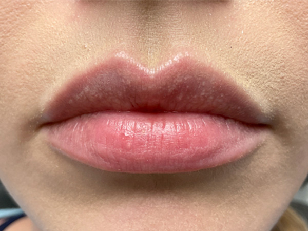 Injectables And Fillers 01