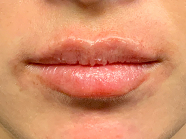 Injectables And Fillers 32