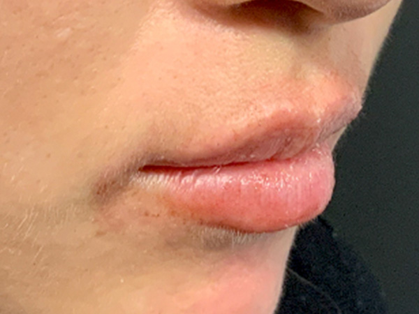 Injectables And Fillers 03