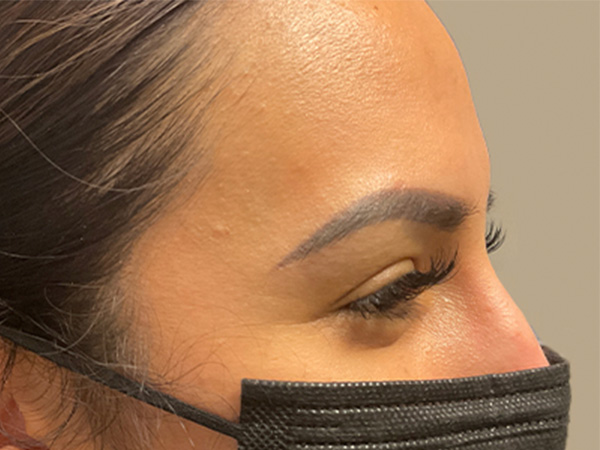 Injectables And Fillers 03