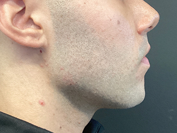 Injectables And Fillers 03