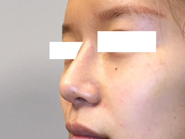 Injectables And Fillers 03