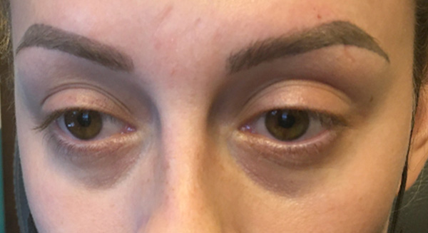 Injectables And Fillers 01