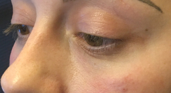 Injectables And Fillers 03