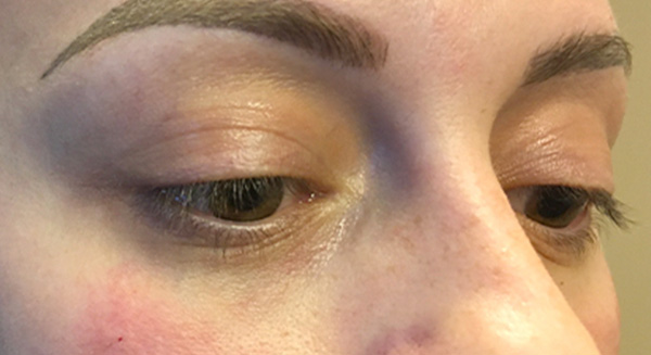 Injectables And Fillers 05