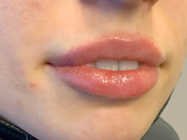 Injectables And Fillers 03