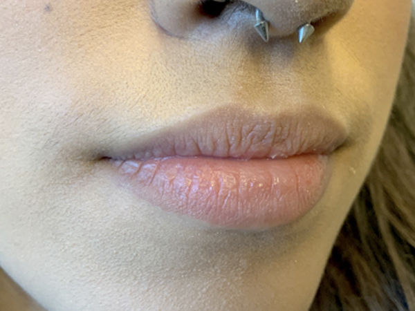 Injectables And Fillers 05