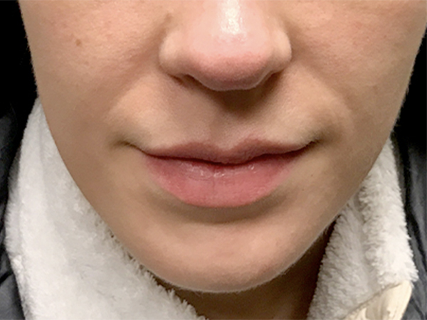 Injectables And Fillers 01