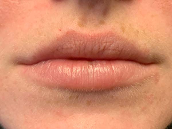 Injectables And Fillers 01