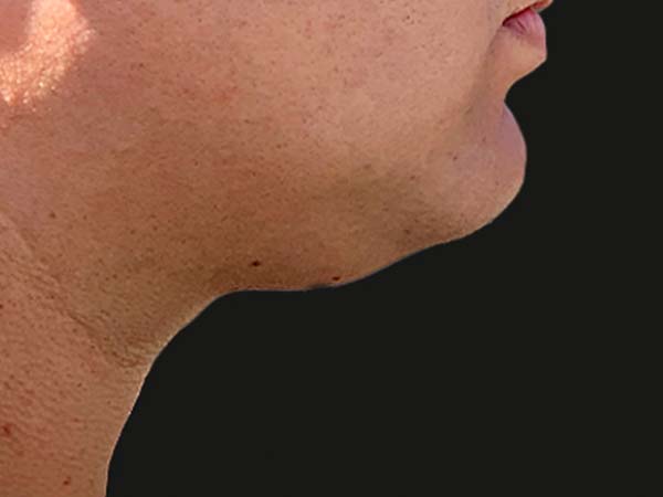 Injectables And Fillers 01