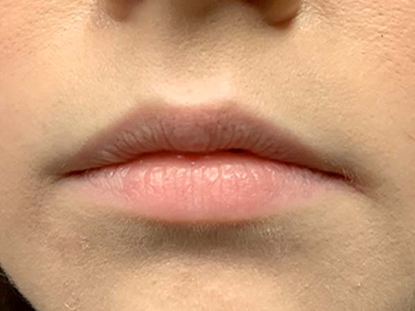 Injectables And Fillers 01